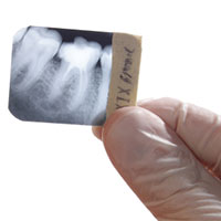 Лазерная стоматология