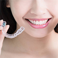 Преимущества и недостатки проволочных ретейнеров