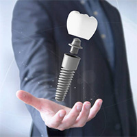 Установка имплантов SigDent (Израиль) в стоматологии «НИКА-МЕД» в Митино